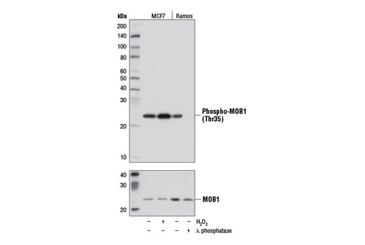  Image 2: PhosphoPlus® MOB1A/MOB1B (Thr35) Antibody Duet