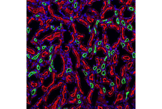 Immunofluorescence Image 1: NKCC2 (D5Q1H) Rabbit mAb (IF Formulated)