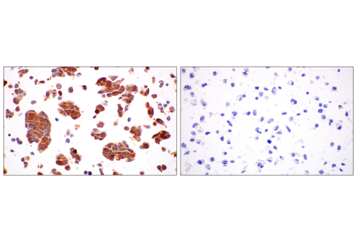  Image 19: Cancer-associated Growth Factor Antibody Sampler Kit