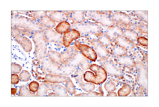  Image 21: Cancer-associated Growth Factor Antibody Sampler Kit