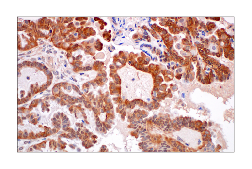  Image 24: Cancer-associated Growth Factor Antibody Sampler Kit