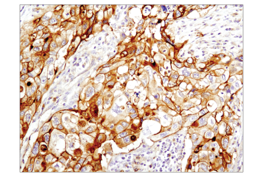 Immunohistochemistry Image 1: NT5E/CD73 (D7F9A) Rabbit mAb (BSA and Azide Free)