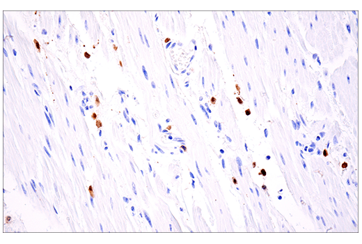 Immunohistochemistry Image 3: Calretinin (E7R6O) XP® Rabbit mAb (BSA and Azide Free)