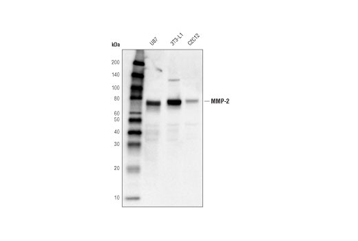  Image 11: Mouse Reactive Senescence Associated Secretory Phenotype (SASP) Antibody Sampler Kit