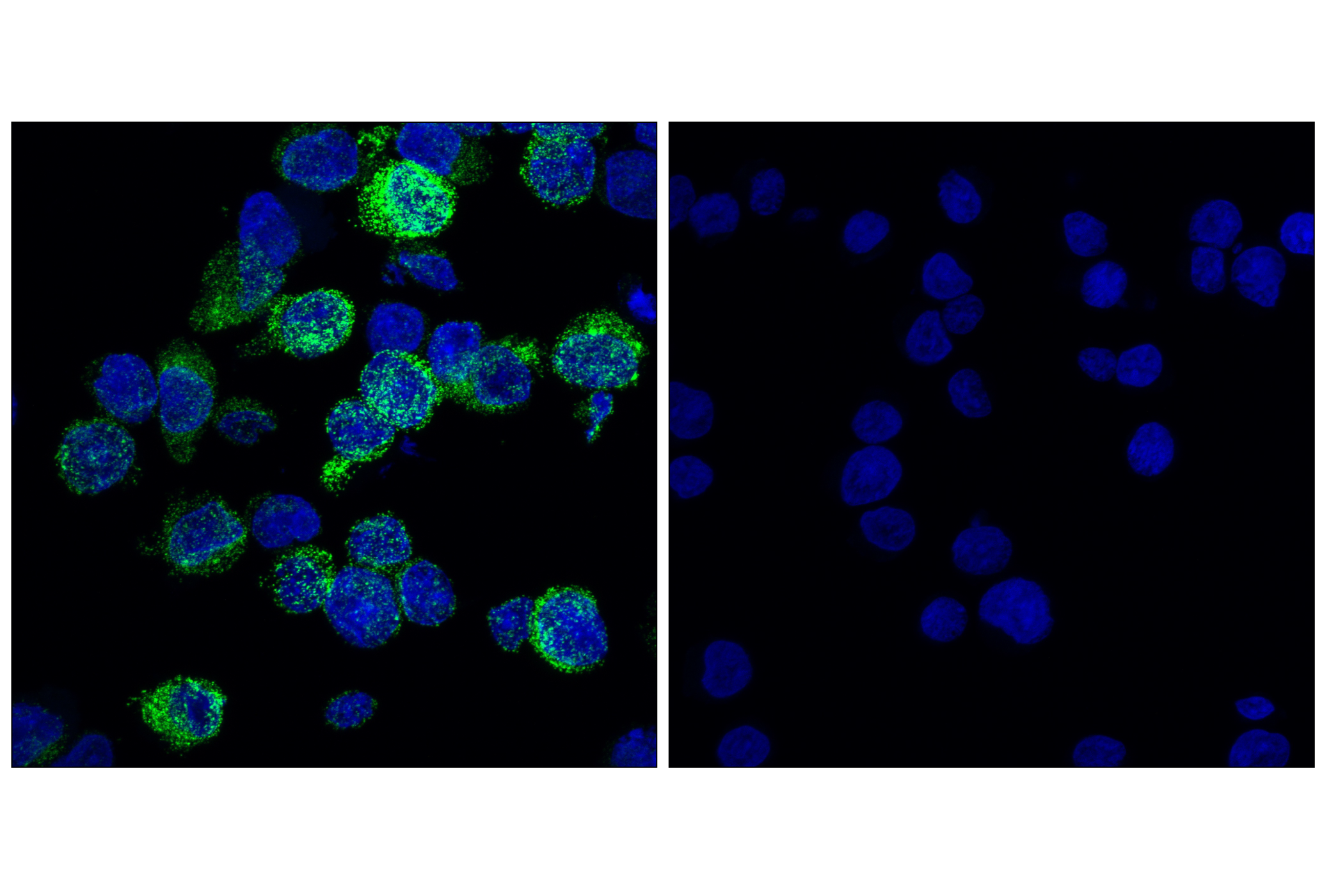 Immunofluorescence Image 1: CD206/MRC1 (E6T5J) XP<sup>®</sup> Rabbit mAb (BSA and Azide Free)