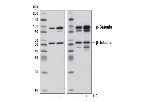 Western Blotting Image 2: Non-phospho (Active) β-Catenin (Ser33/37/Thr41) (D13A1) Rabbit mAb
