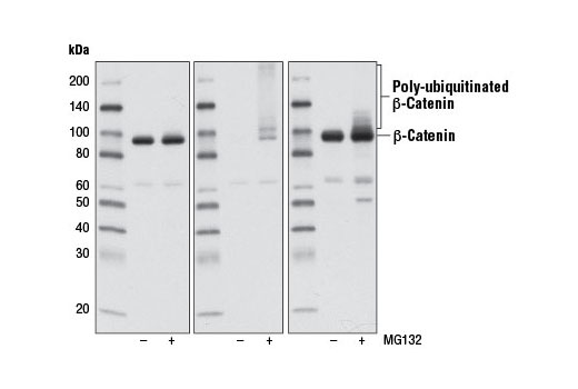 Western Blotting Image 3: Non-phospho (Active) β-Catenin (Ser33/37/Thr41) (D13A1) Rabbit mAb