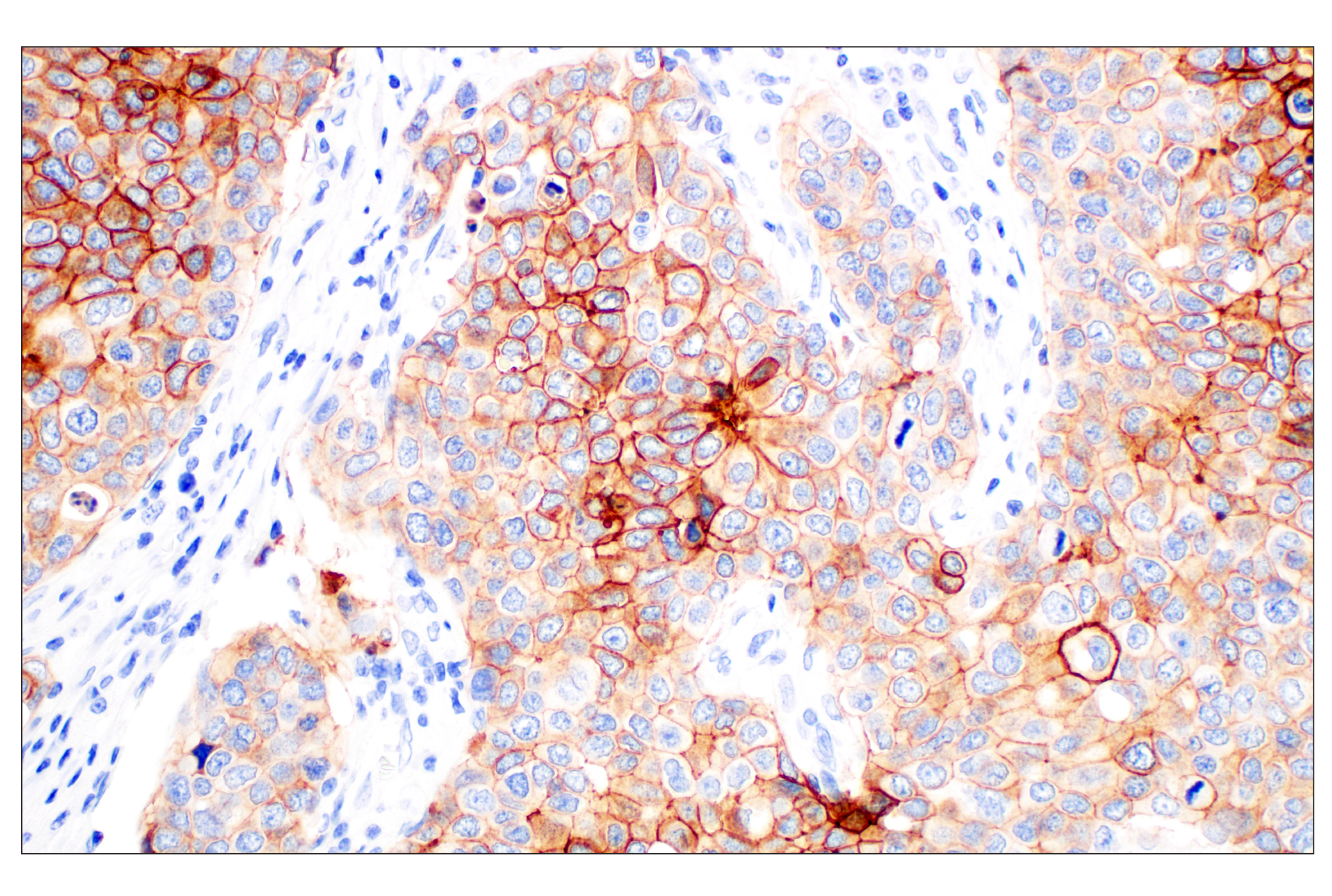 Immunohistochemistry Image 1: TACSTD2/TROP2 (F4W4J) Rabbit mAb (BSA and Azide Free)