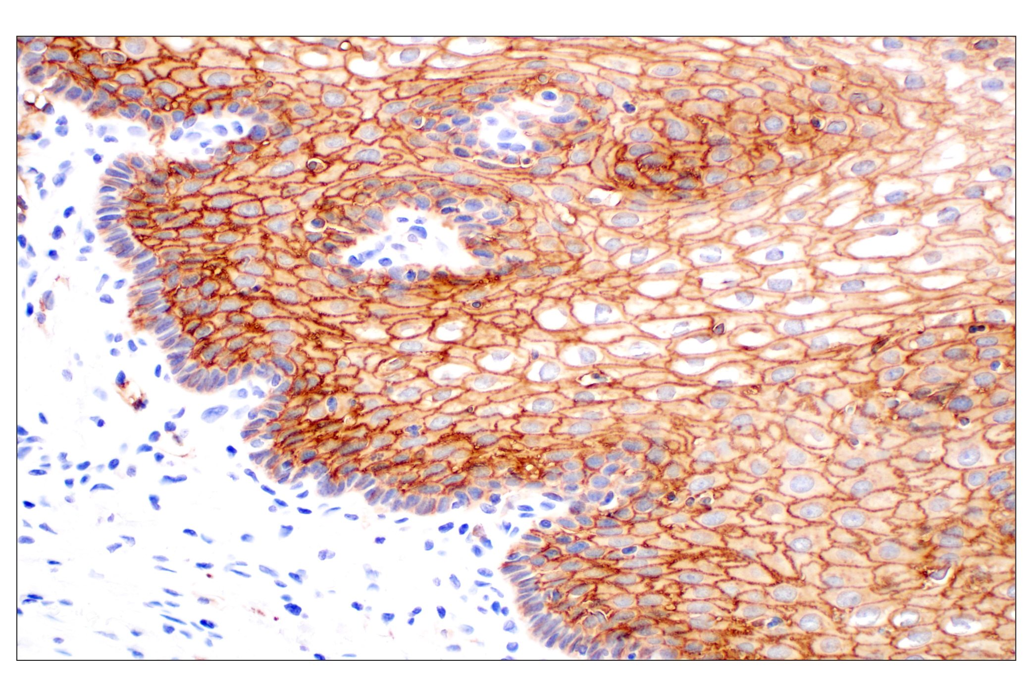 Immunohistochemistry Image 6: TACSTD2/TROP2 (F4W4J) Rabbit mAb (BSA and Azide Free)