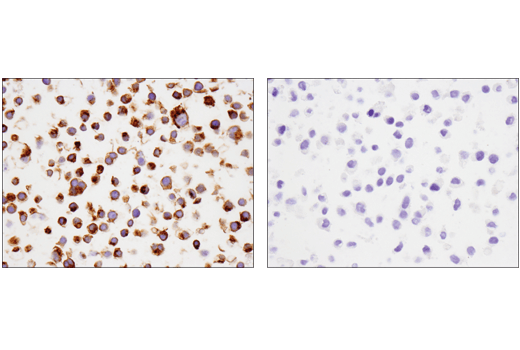 Immunohistochemistry Image 9: TNFRSF17/BCMA (E6D7B) Rabbit mAb