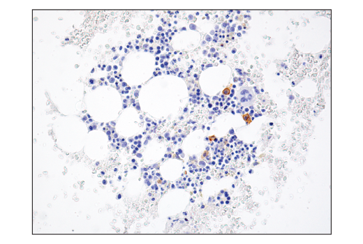 Immunohistochemistry Image 6: TNFRSF17/BCMA (E6D7B) Rabbit mAb