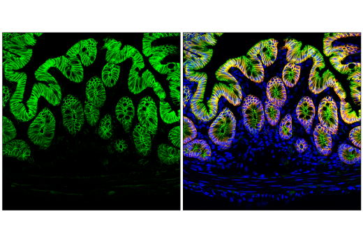 Immunofluorescence Image 1: β-Catenin (D10A8) XP® Rabbit mAb (Alexa Fluor® 488 Conjugate)