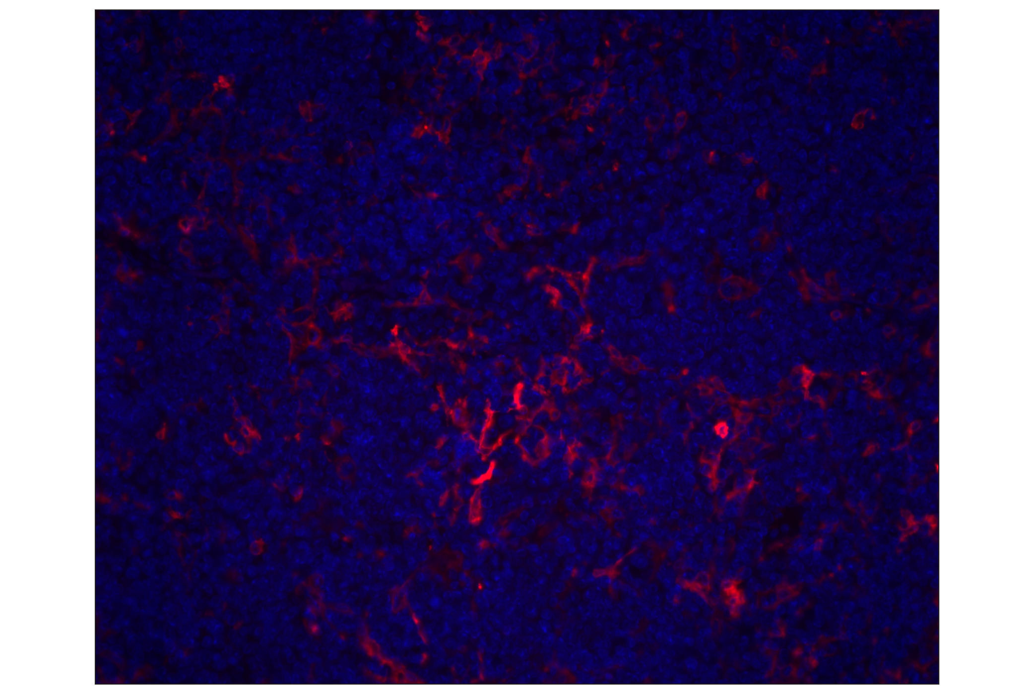 Immunohistochemistry Image 1: CD11c (D1V9Y) Rabbit mAb (Alexa Fluor® 647 Conjugate)