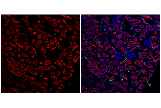 Immunofluorescence Image 4: Cathepsin D (E7Z4L) XP® Rabbit mAb