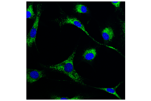 Immunofluorescence Image 5: Cathepsin D (E7Z4L) XP® Rabbit mAb