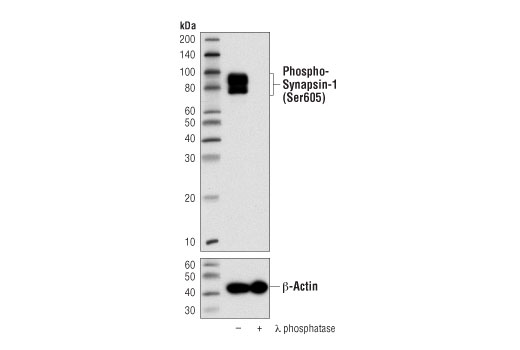 Western Blotting Image 2: Phospho-Synapsin-1 (Ser605) (D4B9I) Rabbit mAb