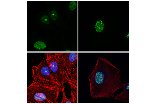Immunofluorescence Image 2: 53BP1 (E7N5D) XP® Rabbit mAb
