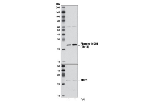  Image 2: PhosphoPlus® MOB1A/MOB1B (Thr12) Antibody Duet