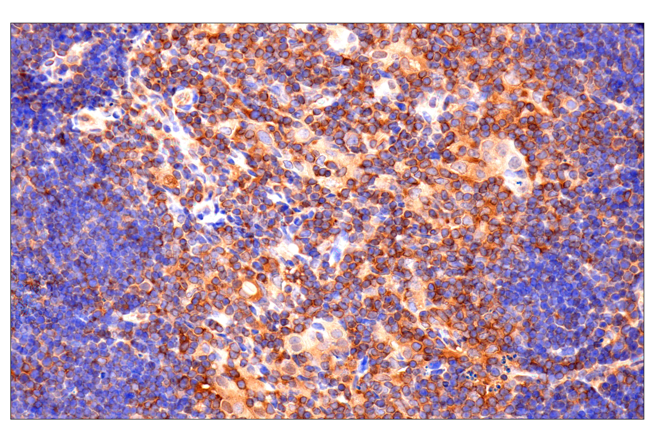 Immunohistochemistry Image 8: Caspase-8 (F5K9P) Rabbit mAb