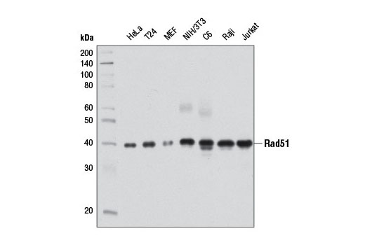 Image 10: Homologous Recombination (HR) DNA Repair Antibody Sampler Kit