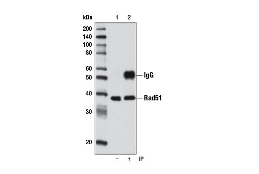  Image 15: Homologous Recombination (HR) DNA Repair Antibody Sampler Kit