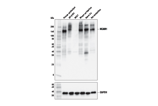 Western Blotting Image 1: NCAM1 (CD56) (E7X9M) XP® Rabbit mAb (BSA and Azide Free)