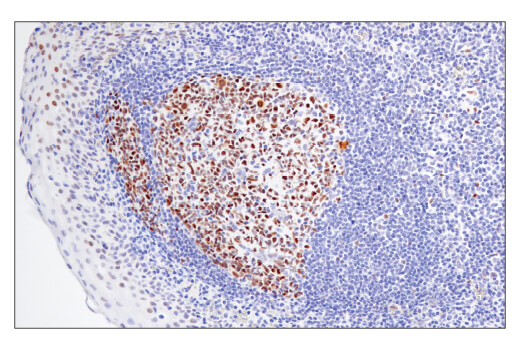 Immunohistochemistry Image 6: BCL6 (E5I8I) Rabbit mAb