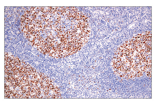 Immunohistochemistry Image 4: BCL6 (E5I8I) Rabbit mAb