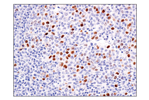 Immunohistochemistry Image 1: BCL6 (E5I8I) Rabbit mAb