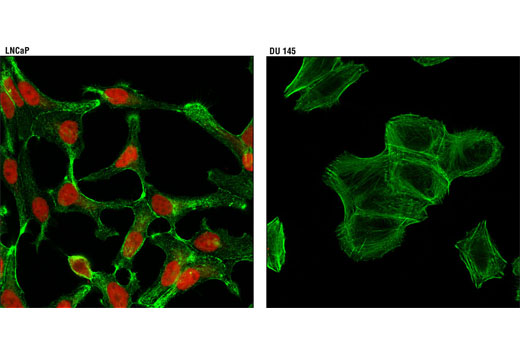 Immunofluorescence Image 1: Androgen Receptor (D6F11) XP® Rabbit mAb (Alexa Fluor® 594 Conjugate)