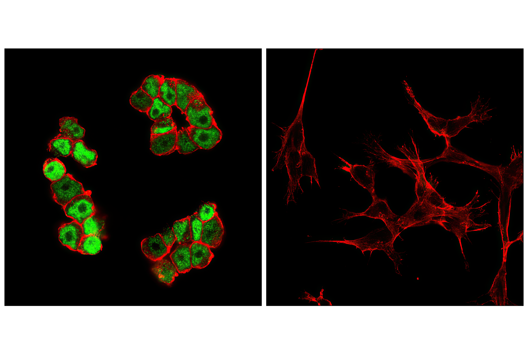 Immunofluorescence Image 1: c-Myc (E5Q6W) Rabbit mAb (BSA and Azide Free)