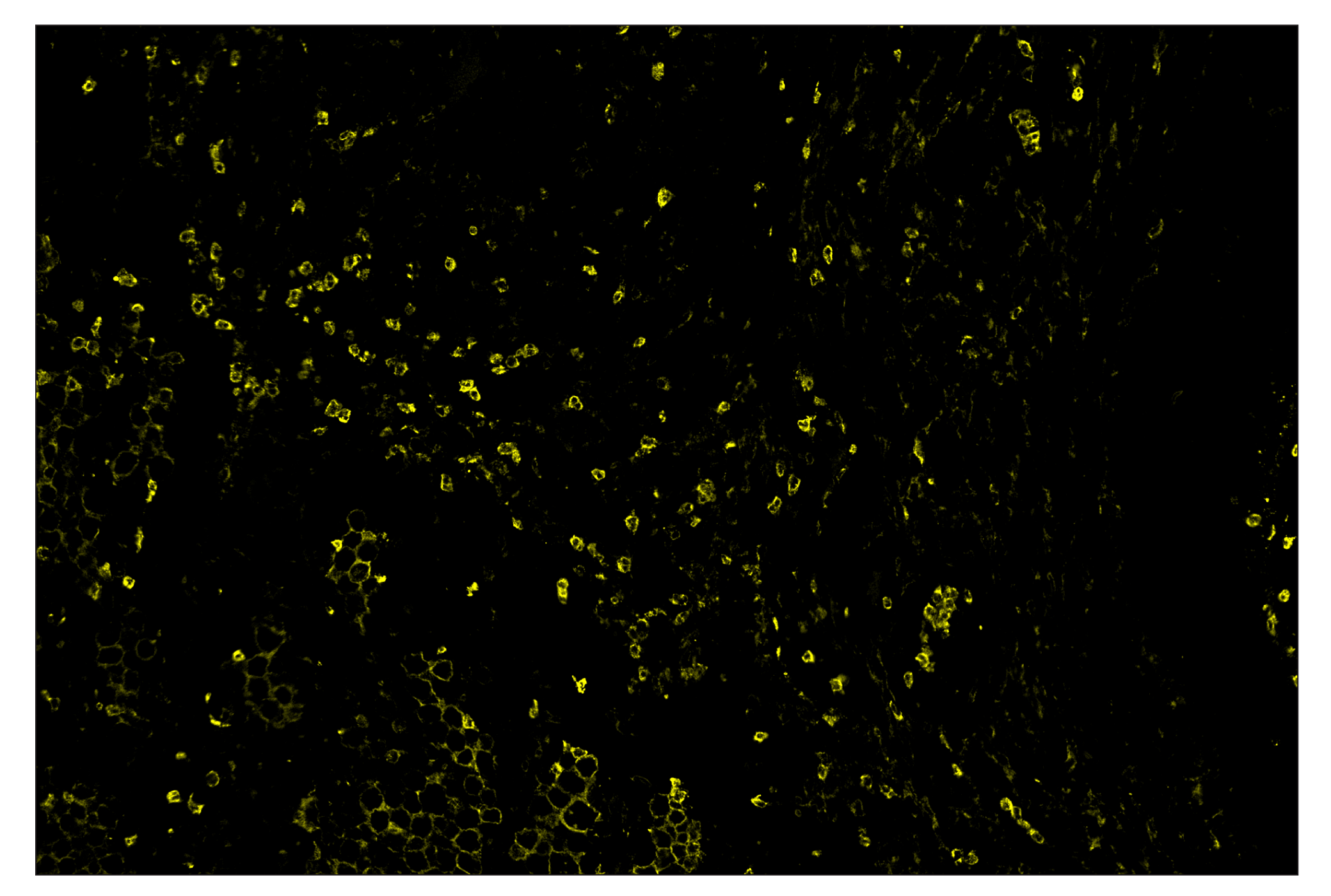 Immunohistochemistry Image 3: CD11b/ITGAM (D6X1N) & CO-0037-750 SignalStar™ Oligo-Antibody Pair