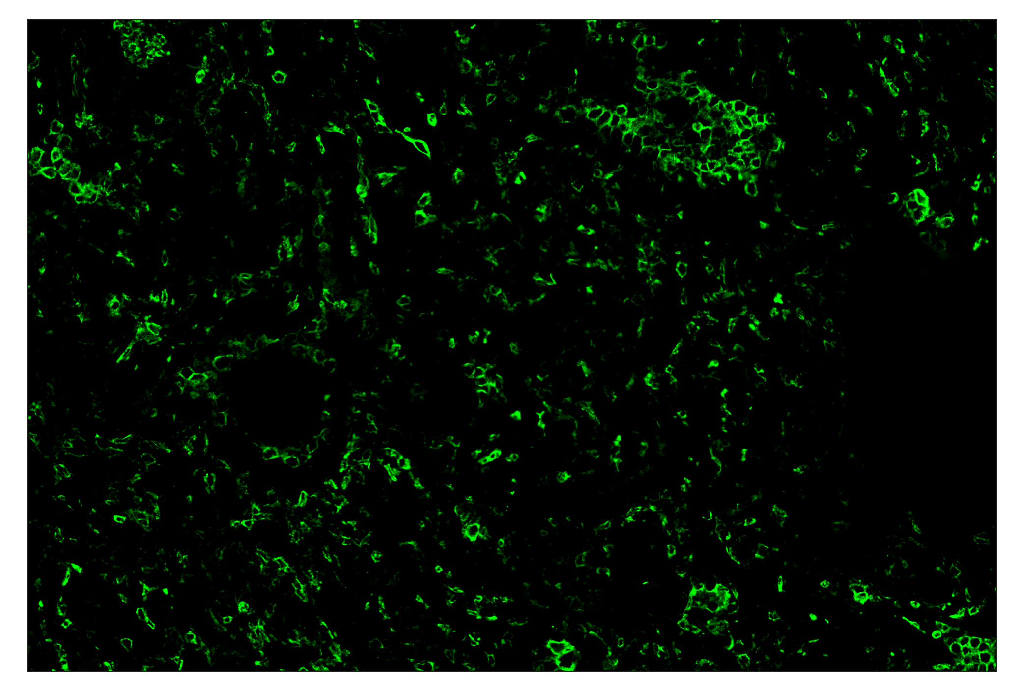 Immunohistochemistry Image 2: CD11b/ITGAM (D6X1N) & CO-0037-647 SignalStar™ Oligo-Antibody Pair
