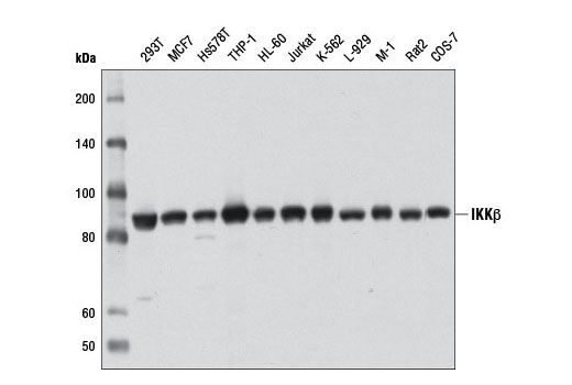  Image 12: NF-κB Pathway Antibody Sampler Kit