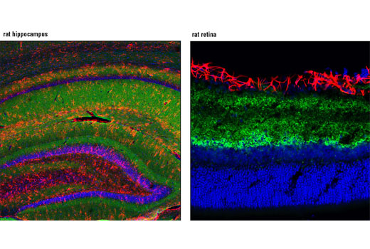  Image 20: Mature Neuron Marker Antibody Sampler Kit