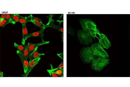 Immunofluorescence Image 1: Androgen Receptor (D6F11) XP® Rabbit mAb (Alexa Fluor® 555 Conjugate)