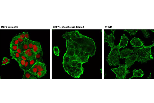 Immunofluorescence Image 1: Phospho-Rb (Ser807/811) (D20B12) XP® Rabbit mAb (Alexa Fluor® 555 Conjugate)