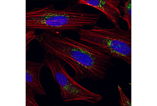 Immunofluorescence Image 1: LAMTOR1/C11orf59 (D11H6) XP® Rabbit mAb