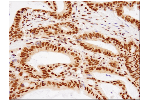 Immunohistochemistry Image 2: TDP43 (D9R3L) Rabbit mAb