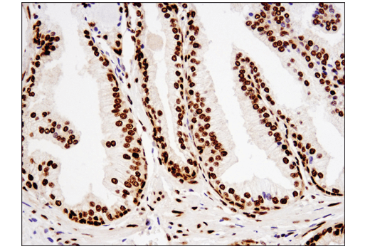 Immunohistochemistry Image 5: TDP43 (D9R3L) Rabbit mAb