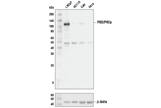  Image 5: Phospho-PKC Antibody Sampler Kit