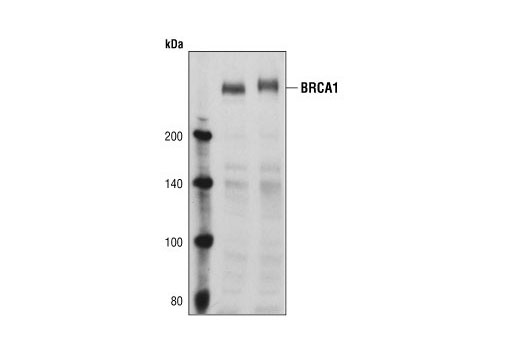 Western Blotting Image 1: BRCA1 Antibody