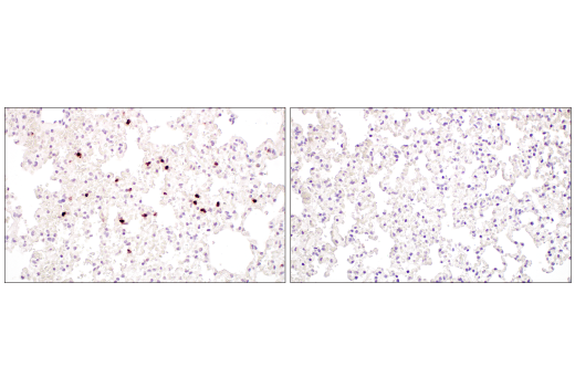 Immunohistochemistry Image 2: Neutrophil Elastase (E8U3X) Rabbit mAb (BSA and Azide Free)