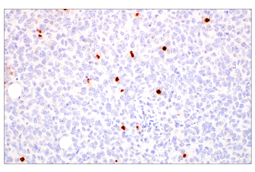 Immunohistochemistry Image 3: Neutrophil Elastase (E8U3X) Rabbit mAb (BSA and Azide Free)