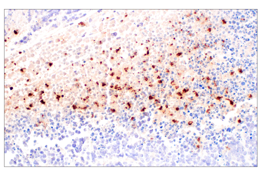 Immunohistochemistry Image 6: Neutrophil Elastase (E8U3X) Rabbit mAb (BSA and Azide Free)