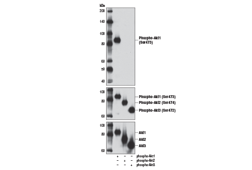  Image 12: Phospho-Akt Isoform Antibody Sampler Kit