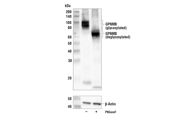  Image 26: Mouse Reactive Alzheimer's Disease Model Microglia Phenotyping IF Antibody Sampler Kit