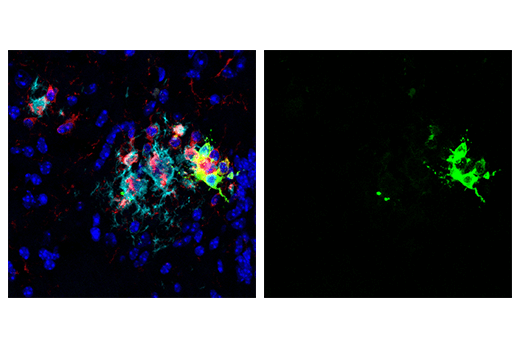  Image 39: Mouse Reactive Alzheimer's Disease Model Microglia Phenotyping IF Antibody Sampler Kit