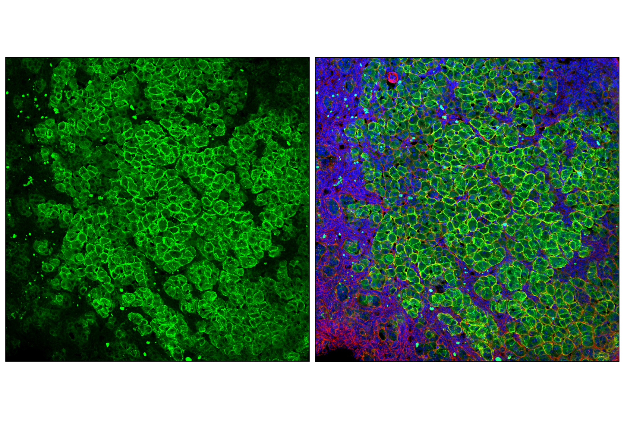 Immunofluorescence Image 1: SCARB1 (E9H4F) Rabbit mAb