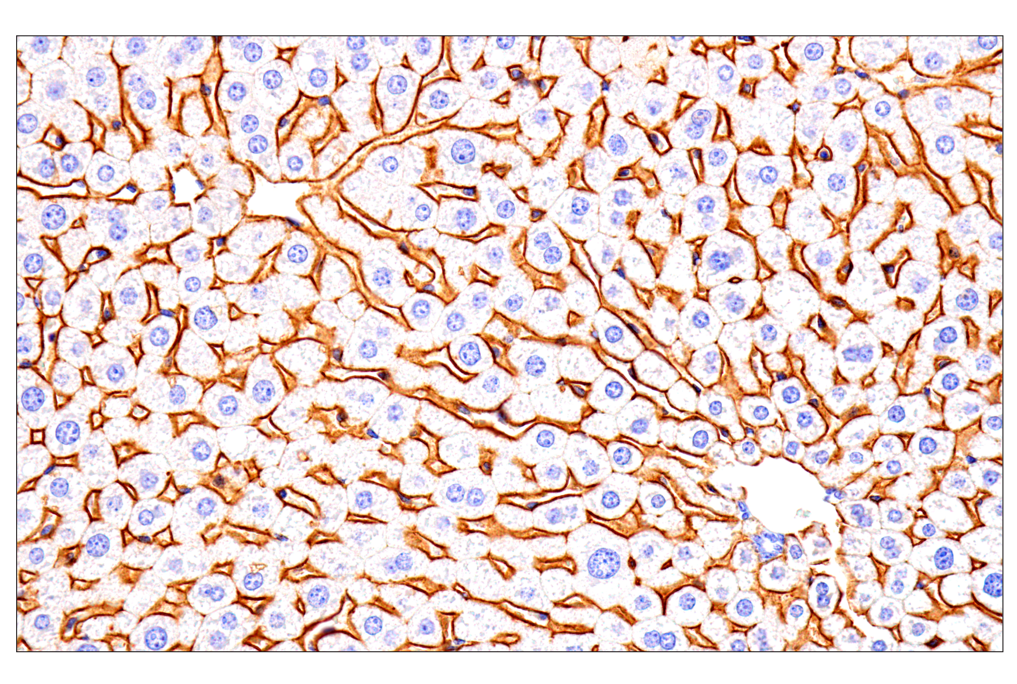 Immunohistochemistry Image 6: SCARB1 (E9H4F) Rabbit mAb